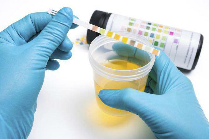 Leukocyte Esterase In The Urine What Is It Leukocyte Esterase In Urinalysis Transcript 2102