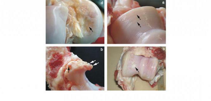 Cartilaginous connective tissue function