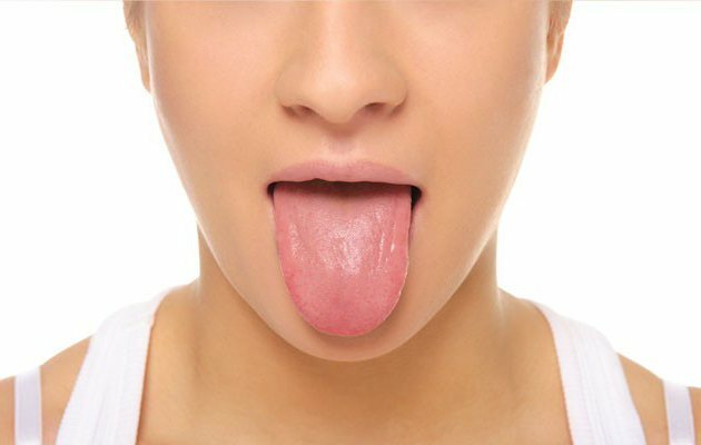 cancer of the tongue signs and symptoms