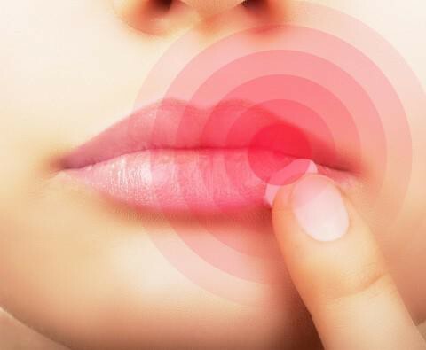 Is it possible to cure herpes on the lips forever?