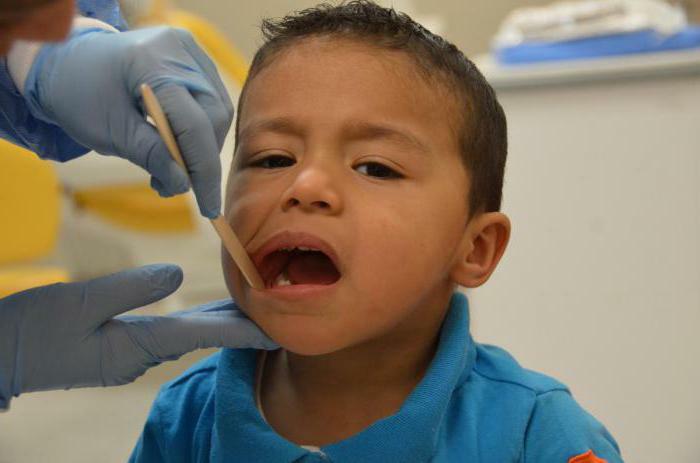 Ulcer on the gums in the child