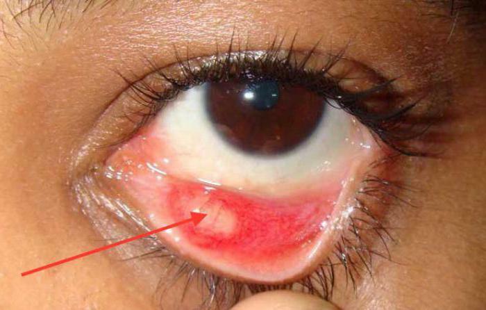 sclera functions