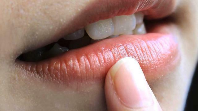 herpes on the gum treatment