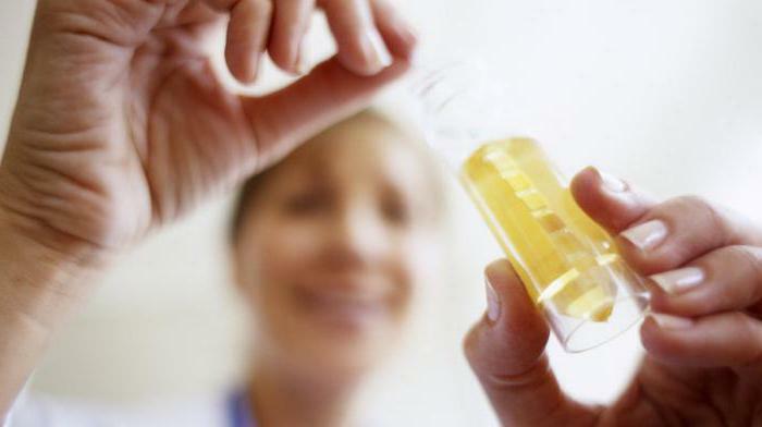 urine analysis for cystitis