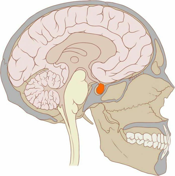 pituitary gland diseases