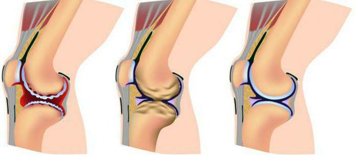 Functions of cartilage and bone tissue