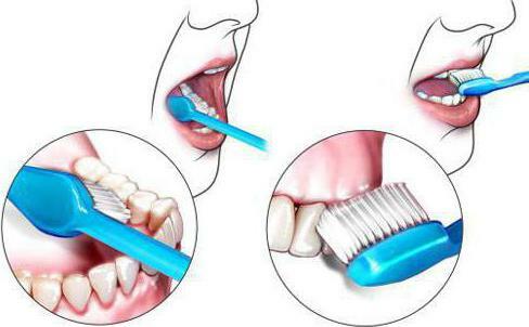 problem with gums parodontosis