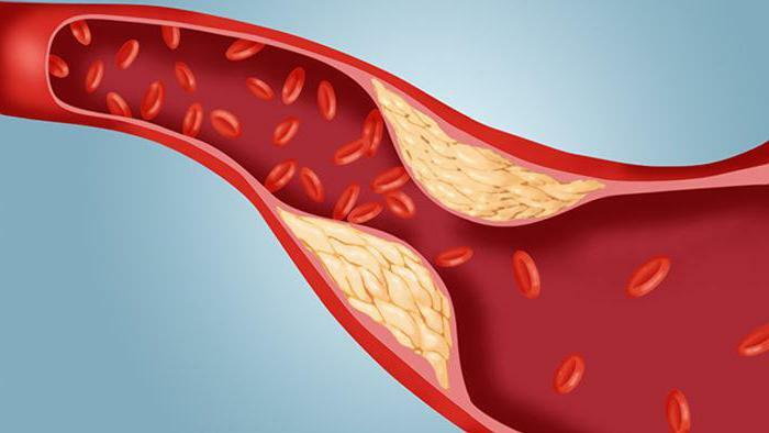 aké potraviny zvyšujú hladinu cholesterolu v krvi človeka