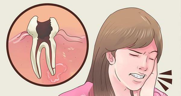what to do if all the teeth hurt at once