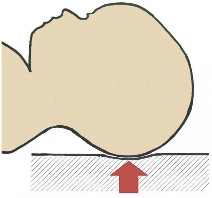 forma oligocefalica della testa di un neonato