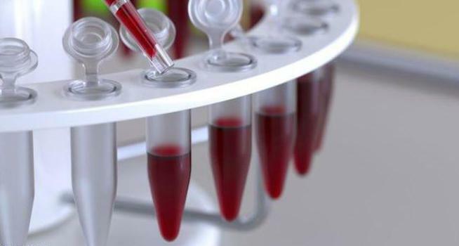 Decoding of HCT blood test