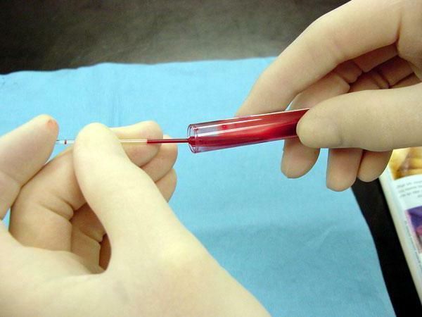 Blood test, HCT norm in women