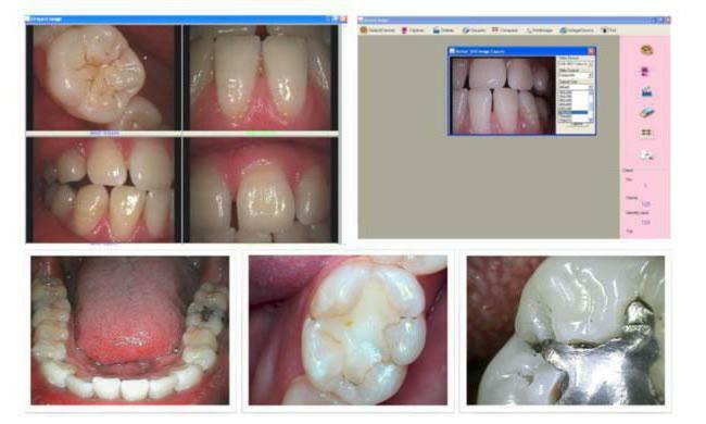 Intraorální zubní komory