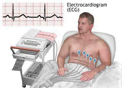 cum sa faci un ecg unui copil