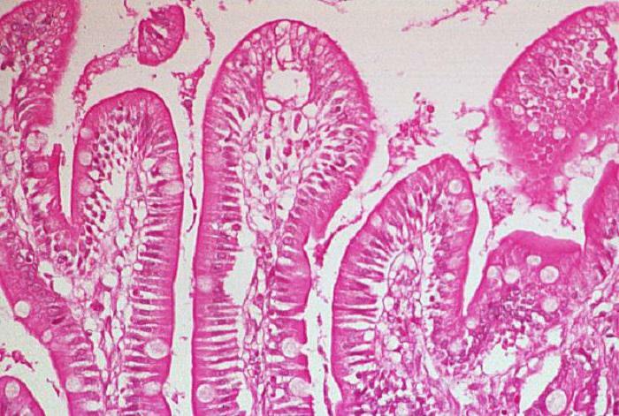 diagnostika syndrómu malabsorpcie