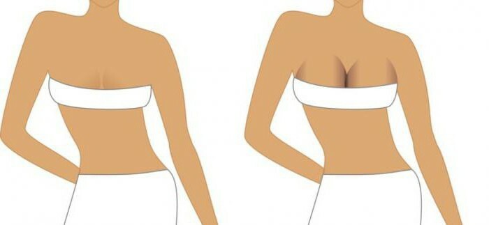 compression underwear after mammoplasty