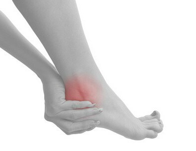 Symptoms of posttraumatic arthrosis of the ankle
