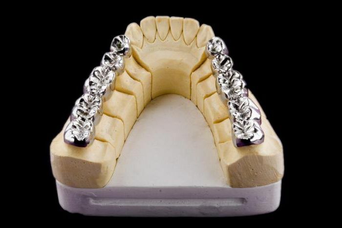 metal crowns on teeth
