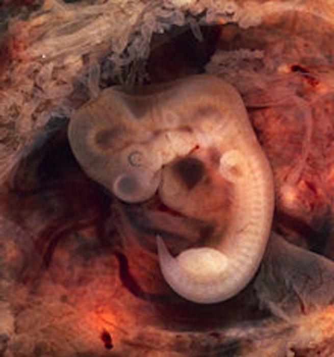 stage of embryo development