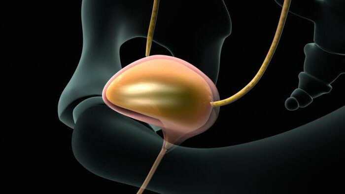 Extraperitoneal rupture of the bladder