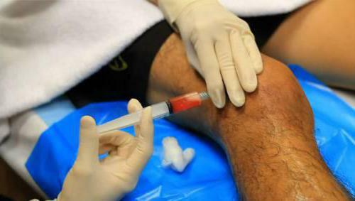 patellofemoral arthrosis treatment