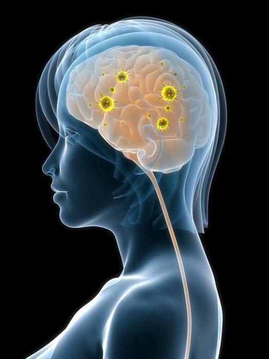 what is neurosyphilis