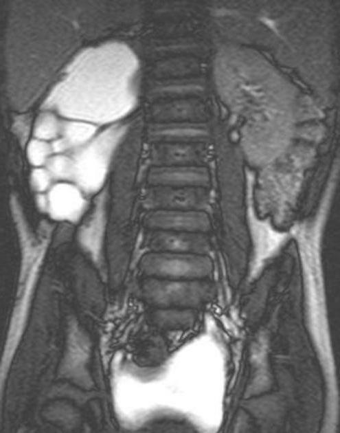 urologie a rinichilor