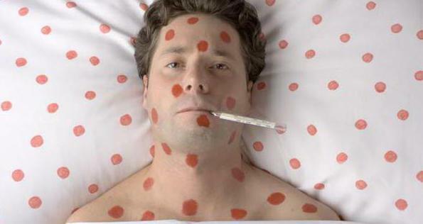 incubation period of chicken pox in adults