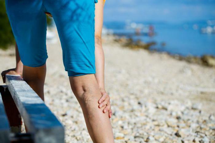 how to treat varicose on the legs of a male medicine