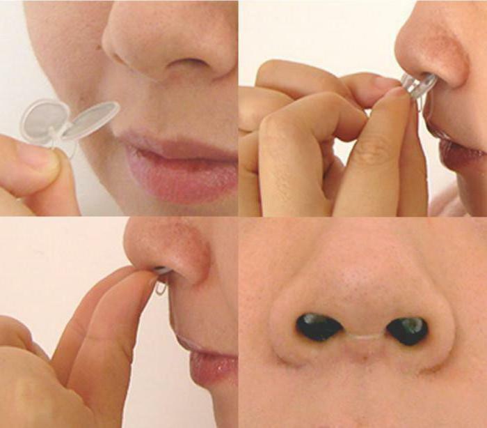 filters for the nose from allergies