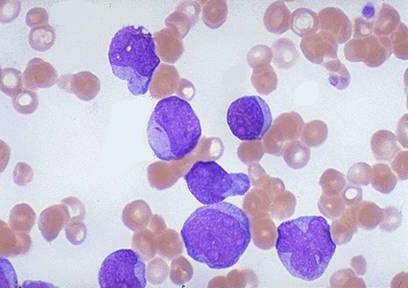 what is the leukocytes in the blood