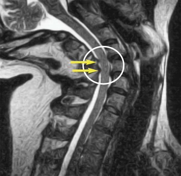 mrd arteries of the neck that shows