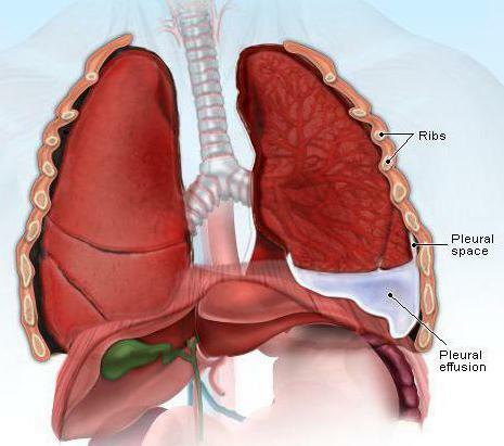 pleural cavity of the lungs
