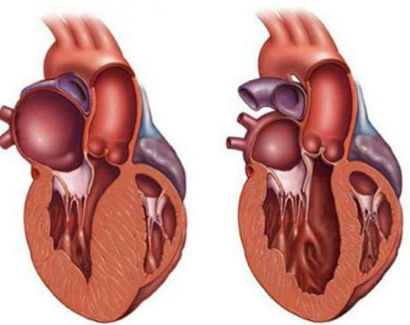 increased heart effects