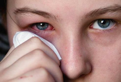conjunctivitis treatment in adult drops