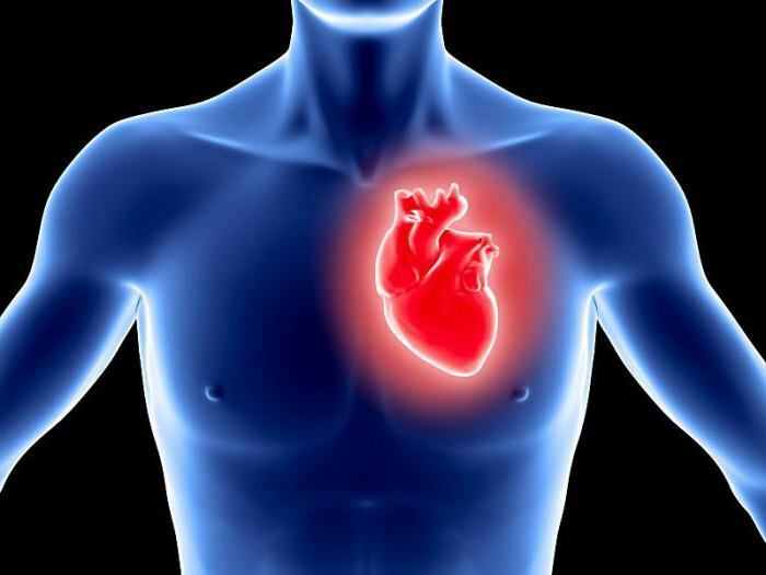 acute transmural myocardial infarction