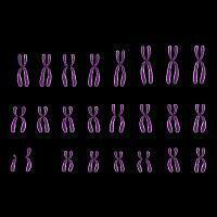 hirschhorn wool syndrome karyotype