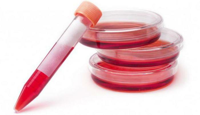 stem cells from umbilical cord blood