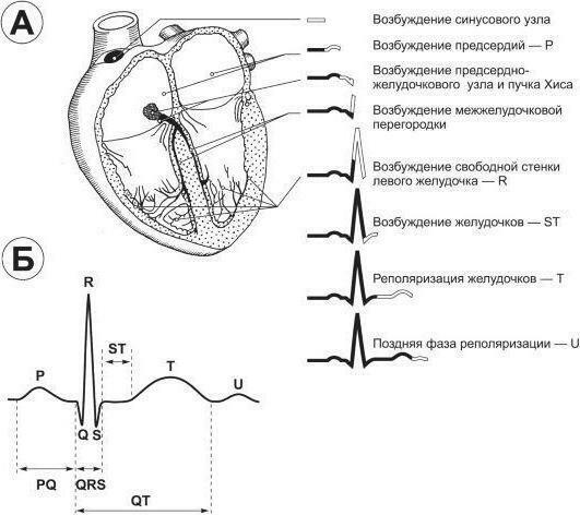 EKG ændringer