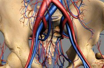 iliac artery operation
