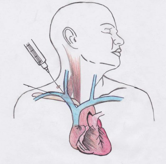 subclavian vein collects blood from