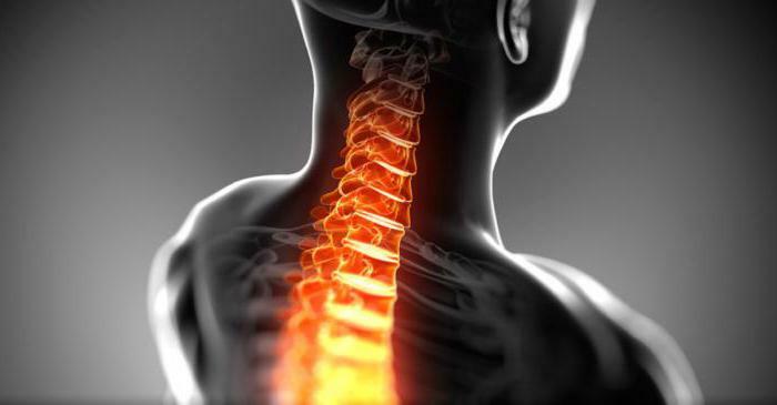 spasms of the muscles of the neck symptoms