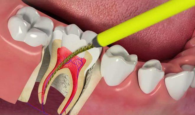 why the tooth needs a nerve