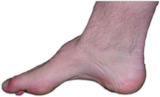 horse foot photo