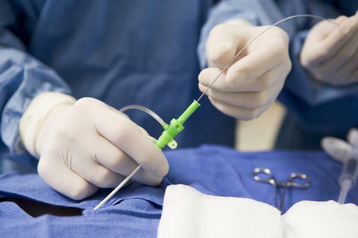 Catheterization of peripheral veins: advantages and disadvantages of ...