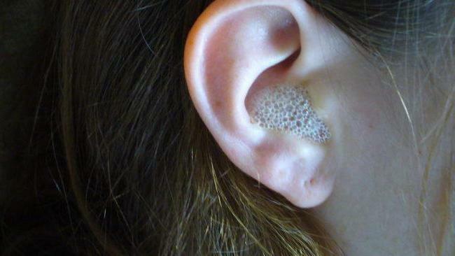 Wash your ear with hydrogen peroxide at home