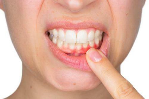 desensitis of the gums