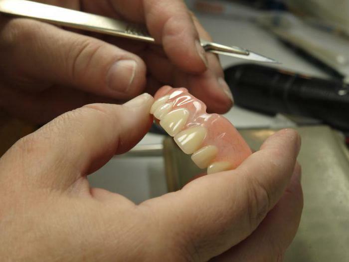Repair of dentures in Moscow
