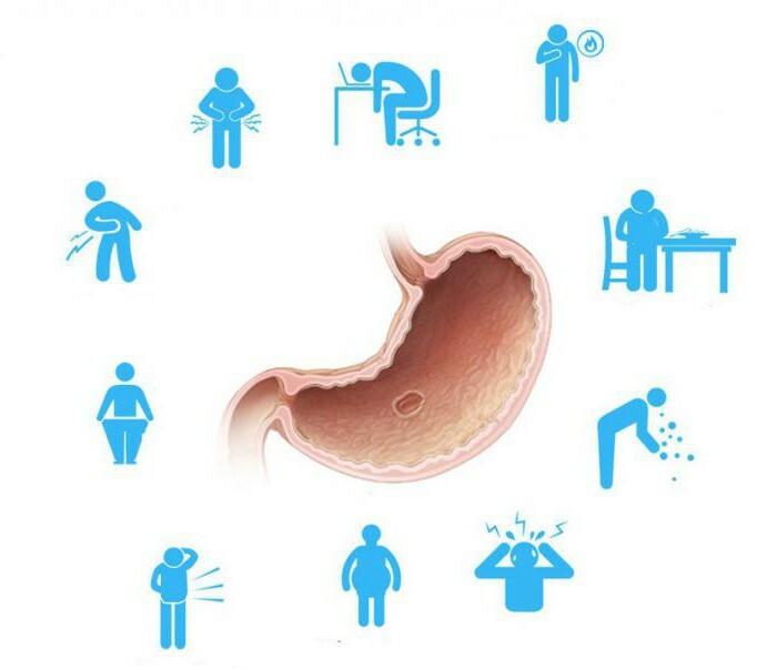 diagnostics of stomach diseases