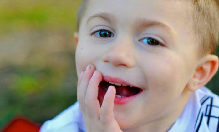 Do you need to treat baby teeth in children?